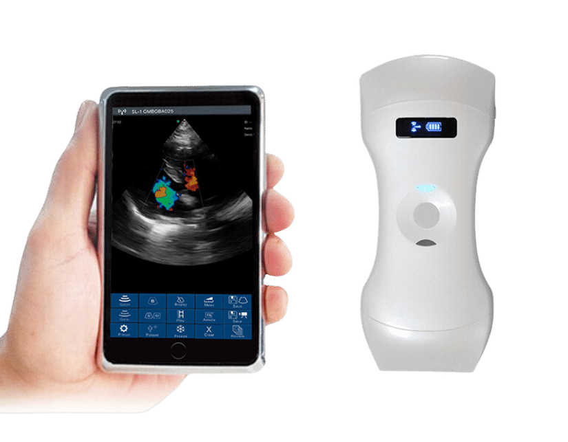 portable point of care ultrasound 2 portable point of care ultrasound 2