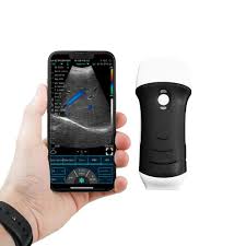 portable point of care ultrasound portable point of care ultrasound