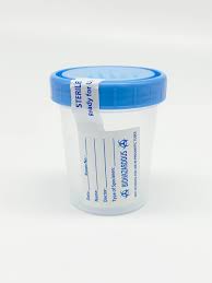 sterile specimen collection kit urine cup 2